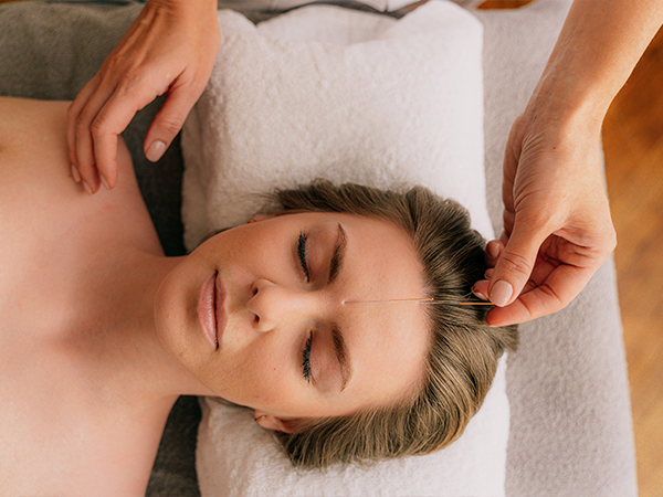 Acupuntura Dermatofuncional